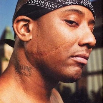 A picture of Maino's scar on the right side of his face.